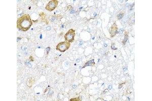 Immunohistochemistry of paraffin-embedded Rat brain using MGP Polyclonal Antibody at dilution of 1:100 (40x lens). (MGP 抗体)