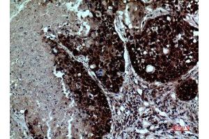 Immunohistochemistry (IHC) analysis of paraffin-embedded Human Lung, antibody was diluted at 1:100. (ITGAD 抗体  (Internal Region))