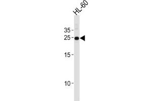 Western Blotting (WB) image for anti-Homeobox A6 (HOXA6) antibody (ABIN2996495) (HOXA6 抗体)