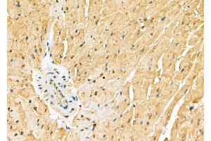 ABIN6265896 and ABIN6278125 at 1/100 staining Rat heart tissue by IHC-P. (UNG 抗体  (Internal Region))