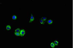 Immunofluorescent analysis of HepG2 cells using ABIN7144042 at dilution of 1:100 and Alexa Fluor 488-congugated AffiniPure Goat Anti-Rabbit IgG(H+L) (APP 抗体  (AA 18-270))