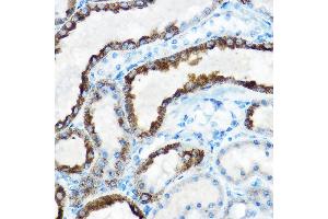 Immunohistochemistry of paraffin-embedded rat kidney using OAT Rabbit pAb (ABIN6127442, ABIN6144985, ABIN6144986 and ABIN6221831) at dilution of 1:150 (40x lens). (OAT 抗体  (AA 160-439))