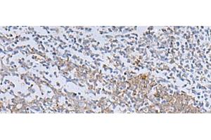 Immunohistochemistry of paraffin-embedded Human tonsil tissue using IL22RA2 Polyclonal Antibody at dilution of 1:70(x200) (IL22RA2 抗体)