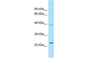 WB Suggested Anti-RAB7L1 Antibody Titration: 1. (RAB7L1 抗体  (C-Term))