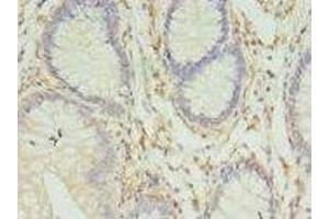 Immunohistochemistry (IHC) image for anti-Major Histocompatibility Complex, Class II, DR beta 4 (HLA-DRB4) (AA 30-227) antibody (ABIN6060855) (HLA-DRB4 抗体  (AA 30-227))