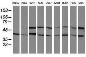 Image no. 2 for anti-Protein Phosphatase, Mg2+/Mn2+ Dependent, 1B (PPM1B) antibody (ABIN1500376) (PPM1B 抗体)