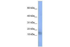 SPATA5 antibody used at 1 ug/ml to detect target protein. (SPATA5 抗体  (Middle Region))