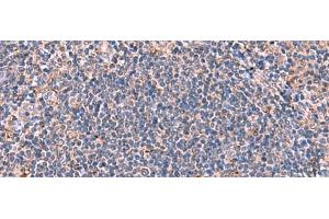 Immunohistochemistry of paraffin-embedded Human tonsil tissue using FDXR Polyclonal Antibody at dilution of 1:85(x200) (Ferredoxin Reductase 抗体)