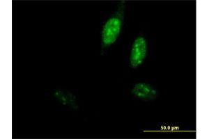 Immunofluorescence of purified MaxPab antibody to POLE3 on HeLa cell.
