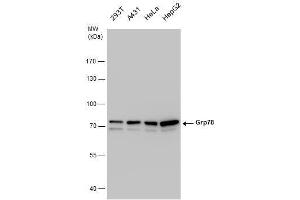 GRP78 抗体  (Internal Region)