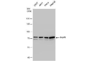 WB Image Grp78 antibody detects Grp78 protein by western blot analysis. (GRP78 抗体  (Internal Region))