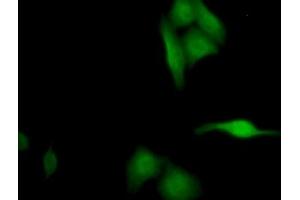 Detection of SEPT5 in Human HepG2 cell using Polyclonal Antibody to Septin 5 (SEPT5) (Septin 5 抗体  (AA 77-323))