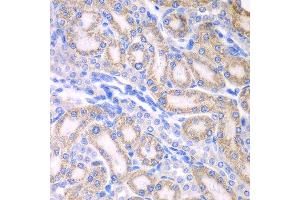 Immunohistochemistry of paraffin-embedded rat kidney using ALDH1A2 antibody at dilution of 1:100 (x400 lens). (ALDH1A2 抗体)