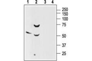 Western blot analysis of rat brain (lanes 1 and 3) and pancreas (lanes 2 and 4) lysates: - 1. (SSTR2 抗体  (Extracellular, N-Term))