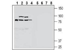 Western blot analysis of rat small intestine lysate (lanes 1 and 5), mouse liver lysate (lanes 2 and 6), rat liver lysate (lanes 3 and 7) and rat brain lysate (lanes 4 and 8): - 1-4. (SLC30A10 抗体  (C-Term, Intracellular))