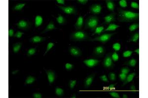 Immunofluorescence of monoclonal antibody to THRAP5 on HeLa cell. (MED16 抗体  (AA 1-110))