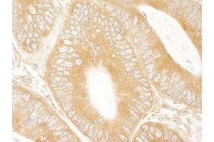 Immunohistochemistry (IHC) image for anti-ATP-Binding Cassette, Sub-Family F (GCN20), Member 1 (ABCF1) (AA 795-845) antibody (ABIN7448398)