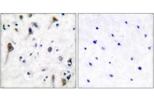 Immunohistochemistry (IHC) image for anti-PTK2B Protein tyrosine Kinase 2 beta (PTK2B) (AA 546-595), (pTyr580) antibody (ABIN1531240)