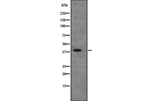 Western blot analysis of EIF2B2 expression in A431 whole cell lysate ,The lane on the left is treated with the antigen-specific peptide. (EIF2B2 抗体  (Internal Region))