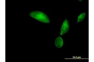Immunofluorescence of purified MaxPab antibody to TMOD3 on HeLa cell. (TMOD3 抗体  (AA 1-352))