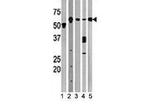 Western blot testing of Beclin antibody and (1) A2058, (2) HeLa, (3) mouse brain, (4) Y79, and (5) HL-60 lysate (Beclin 1 抗体  (AA 210-239))