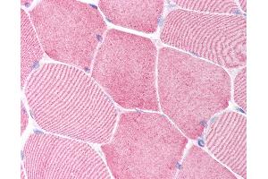 Anti-Caspase 6 antibody IHC of human skeletal muscle. (Caspase 6 抗体  (N-Term))