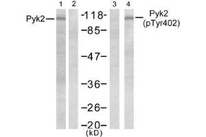 Western blot analysis of extract from Jurkat cells, untreated or treated with PMA (1ng/ml, 5min), using Pyk2 (Ab-402) antibody (E021209, Lane 1 and 2) and Pyk2 (phospho- Tyr402) antibody (E011216, Lane 3 and 4). (PTK2B 抗体)