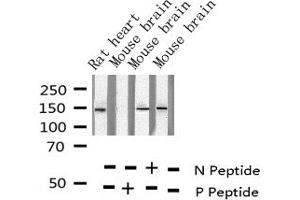 Western blot analysis of Phospho-Met (Tyr1349) expression in various lysates (c-MET 抗体  (pTyr1349))