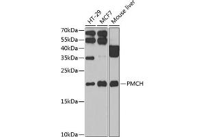 Western blot analysis of extracts of various cell lines, using PMCH antibody (ABIN6130564, ABIN6145812, ABIN6145813 and ABIN6222401) at 1:1000 dilution. (PMCH 抗体  (AA 22-165))