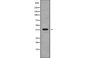 Western blot analysis NKX23 using RAW264. (NK2 Homeobox 3 抗体  (Internal Region))
