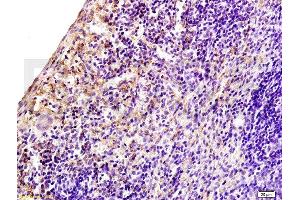 Formalin-fixed and paraffin embedded rat spleen tissue labeled with Anti-CD97 Polyclonal Antibody, Unconjugated at 1:200 followed by conjugation to the secondary antibody, (SP-0023), and DAB staining (CD97 抗体  (AA 741-835))