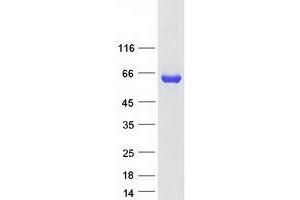 Validation with Western Blot