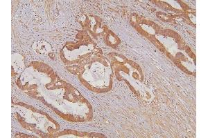 IHC analysis of KIF15 using anti-KIF15 antibody (ABIN6719385).