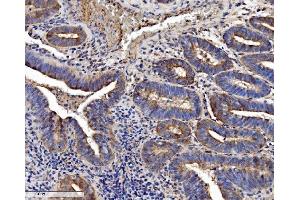 IHC analysis of SEC14L3/TAP2 using anti-SEC14L3/TAP2 antibody (ABIN7601623).
