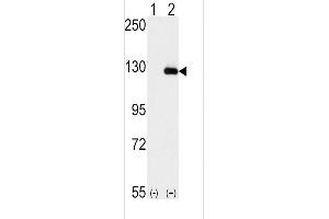 Western blot analysis of BUB1B (arrow) using rabbit polyclonal BUB1B Antibody (N-term) (ABIN392627 and ABIN2842137). (BUB1B 抗体  (N-Term))