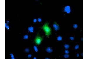 Anti-CDKN3 mouse monoclonal antibody (ABIN2455049) immunofluorescent staining of COS7 cells transiently transfected by pCMV6-ENTRY CDKN3 (RC213080). (CDKN3 抗体)