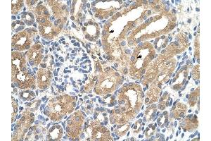 ADAMTS4 antibody was used for immunohistochemistry at a concentration of 4-8 ug/ml to stain Epithelial cells of renal tubule (arrows) in Human Kidney. (ADAMTS4 抗体  (N-Term))