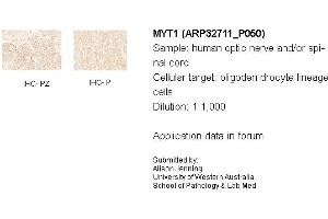 Sample Type: Human Optic Nerve and Spinal CordCellular Target: Oligoden Drocyte Lineage cellsDilution: 1:1000 (MYT1 抗体  (N-Term))