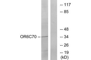 Western blot analysis of extracts from Jurkat cells, using OR6C70 antibody. (OR6C70 抗体  (C-Term))