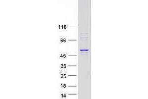Western Blotting (WB) image for Aurora Kinase A (AURKA) (Transcript Variant 6) protein (Myc-DYKDDDDK Tag) (ABIN2715080)