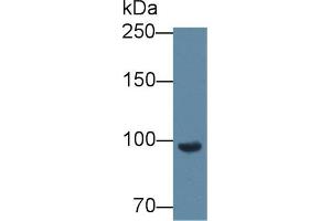 Western blot analysis of Mouse Blood Cells lysate, using Mouse CFB Antibody (2 µg/ml) and HRP-conjugated Goat Anti-Rabbit antibody ( (Complement Factor B 抗体  (AA 474-590))