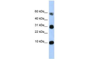 WB Suggested Anti-FABP4 Antibody Titration:  0. (FABP4 抗体  (Middle Region))
