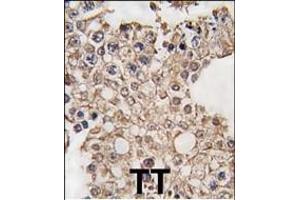 Formalin-fixed and paraffin-embedded human testis tissue reacted with GRK4 antibody (C-term), which was peroxidase-conjugated to the secondary antibody, followed by DAB staining. (GRK4 抗体  (C-Term))