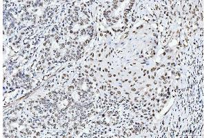 IHC analysis of CTBP2 using anti-CTBP2 antibody (ABIN7601325). (CTBP2 抗体  (AA 321-445))