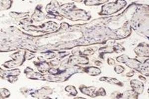Immunohistochemistry analysis of paraffin-embedded human placenta using,PFDN4 (ABIN7075171) at dilution of 1: 4200 (PFDN4 抗体)