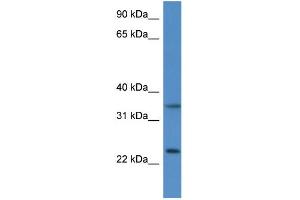 WB Suggested Anti-Cyb5r1 Antibody   Titration: 1. (CYB5R1 抗体  (N-Term))