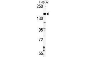 Image no. 1 for anti-Nestin (NES) antibody (ABIN357404) (Nestin 抗体)