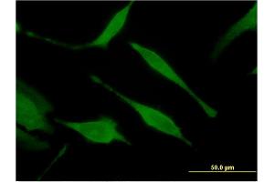 Immunofluorescence of monoclonal antibody to HINT1 on HeLa cell. (HINT1 抗体  (AA 1-126))