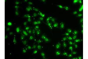 Immunofluorescence analysis of A549 cell using L3MBTL1 antibody. (L3MBTL1 抗体)