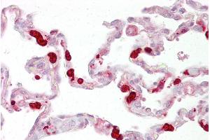 Immunohistochemistry with Lung tissue at an antibody concentration of 5µg/ml using anti-GSTT1 antibody (ARP48490_P050) (GSTT1 抗体  (C-Term))